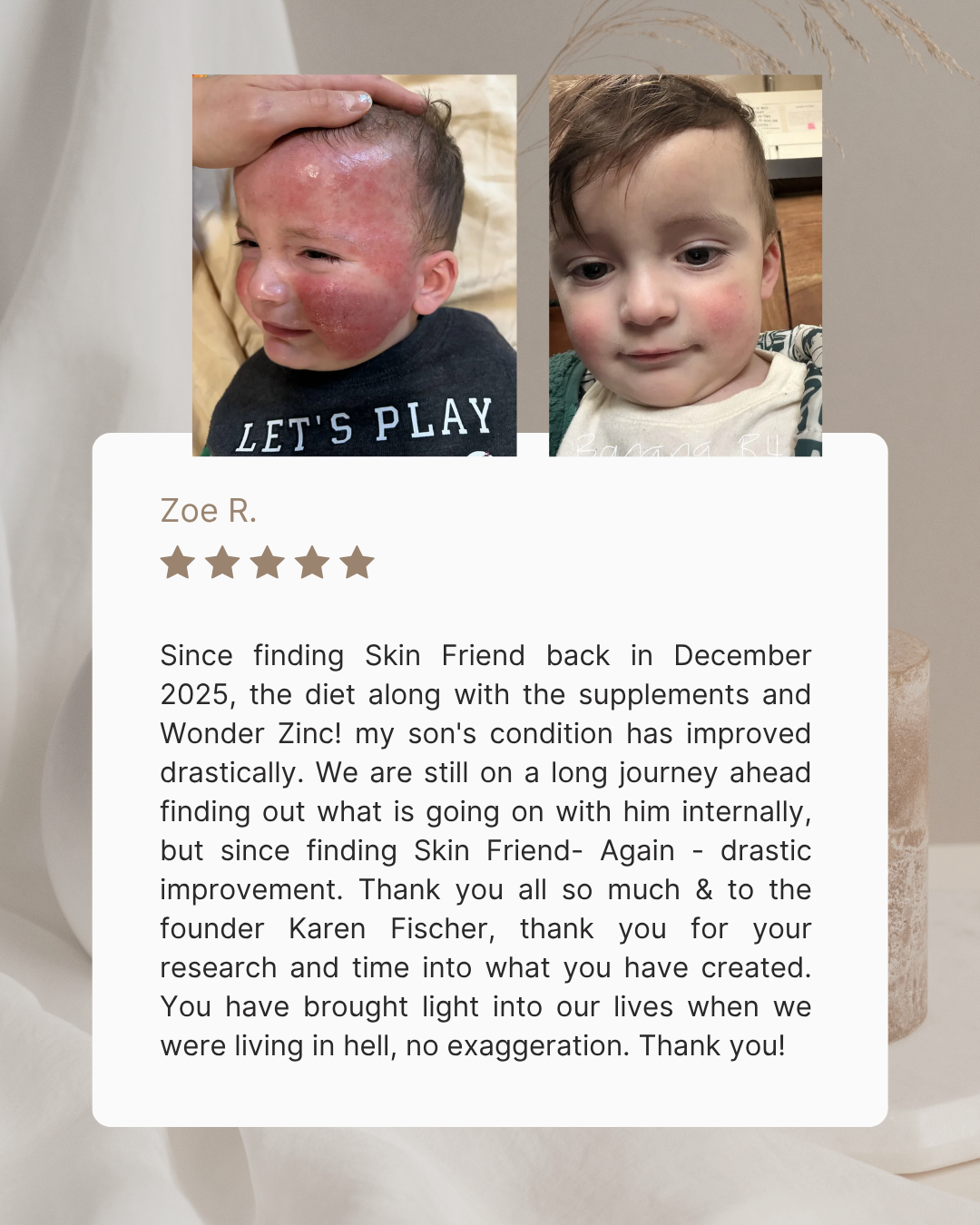 Wonder Zinc | Rash Cream