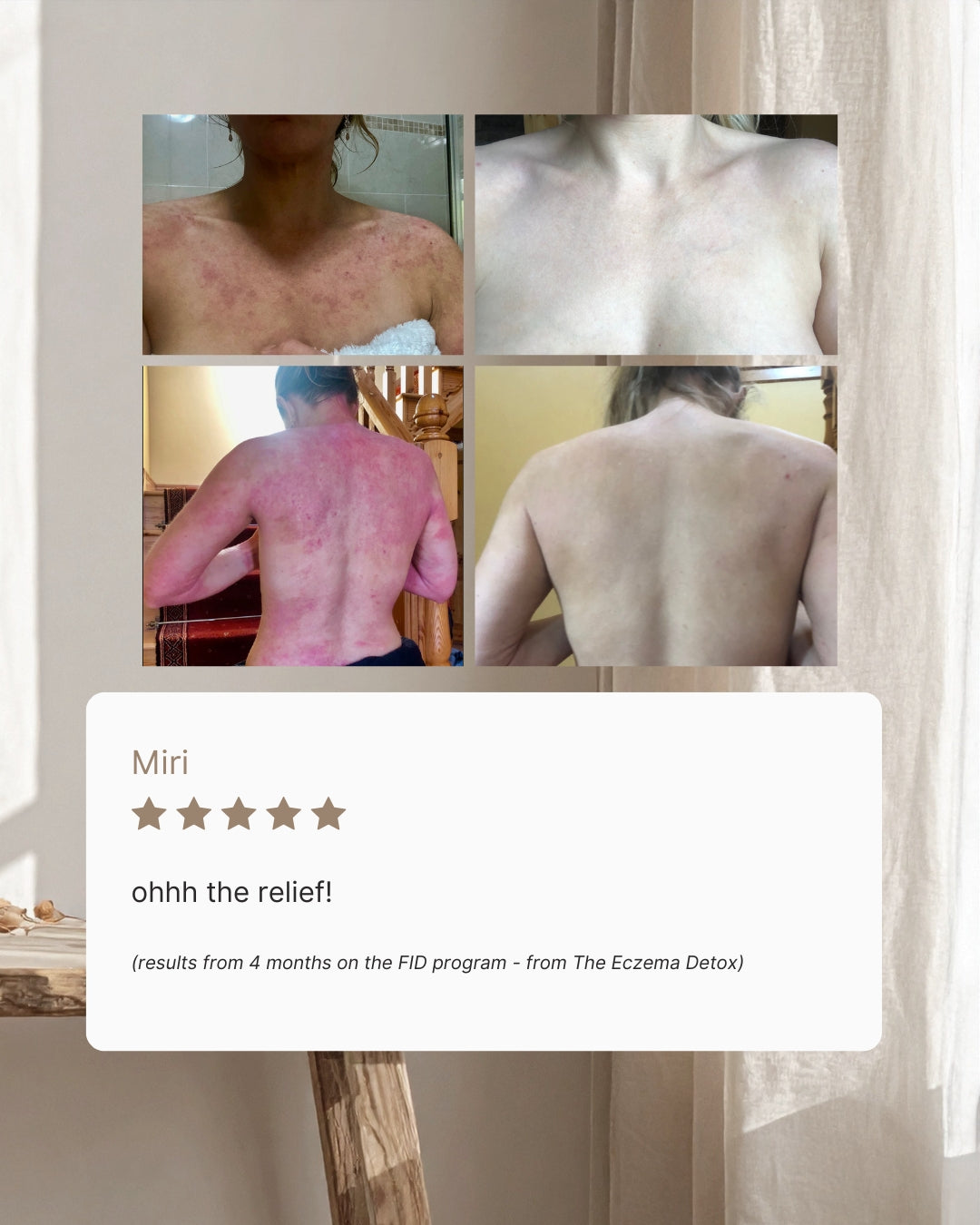 Eczema Clear Skin Toolkit