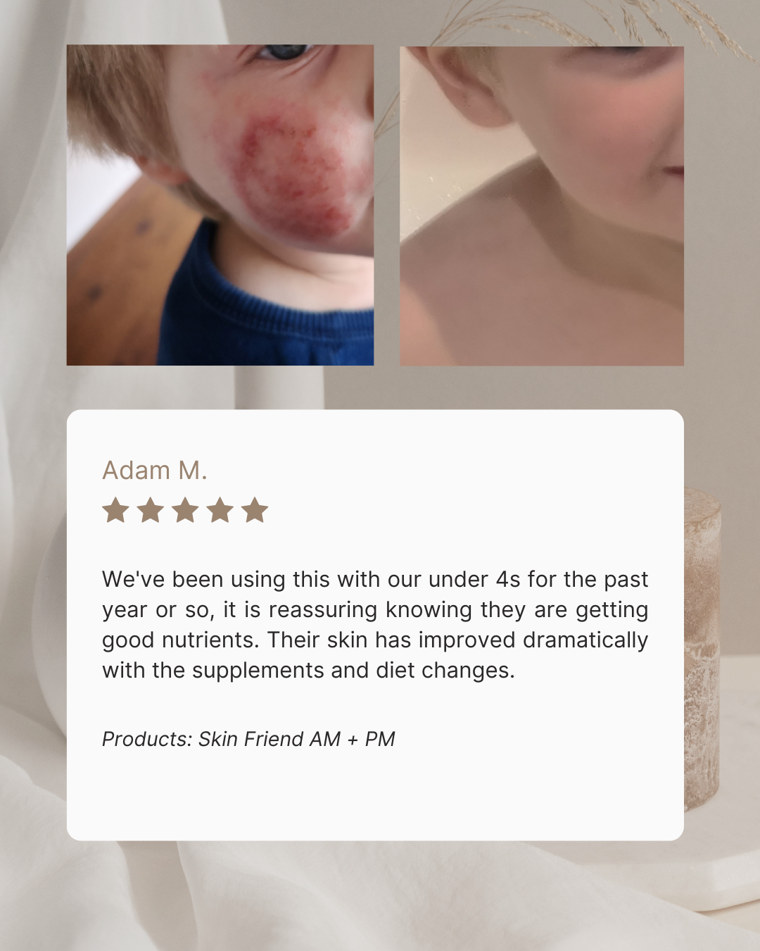 AM Activated Multi | Skin & Gut