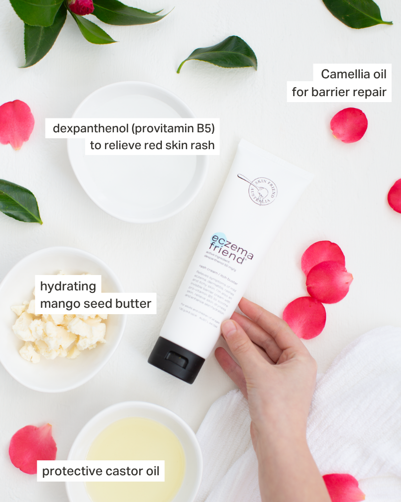 Eczema Friend | Rash Cream
