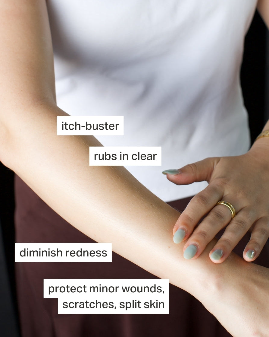 Wonder Zinc | Rash Cream