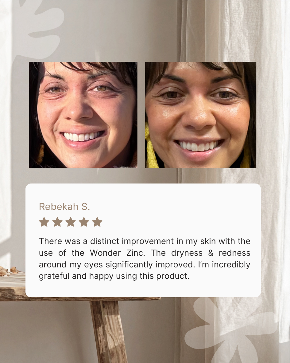 Wonder Zinc | Rash Cream