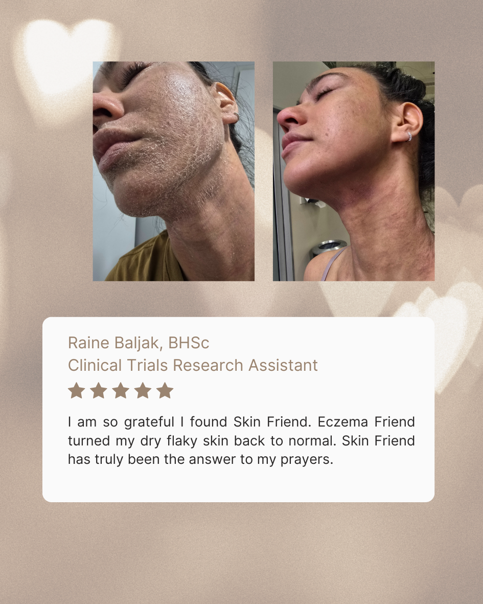 Eczema Friend | Rash Cream
