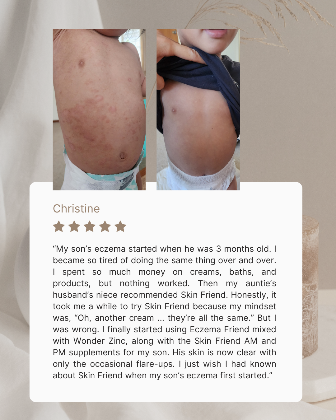 Eczema Friend | Rash Cream