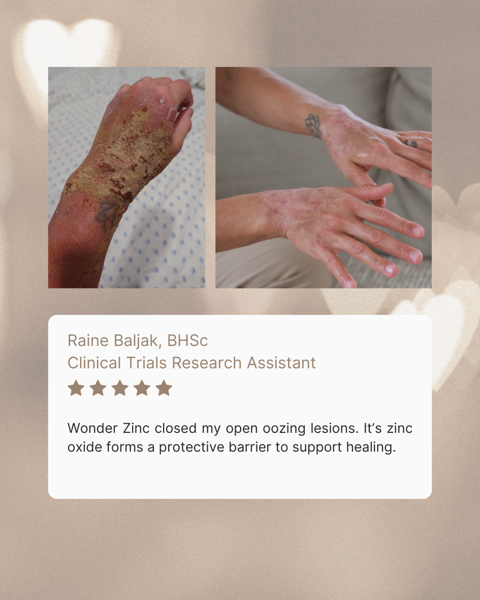 Wonder Zinc | Rash Cream